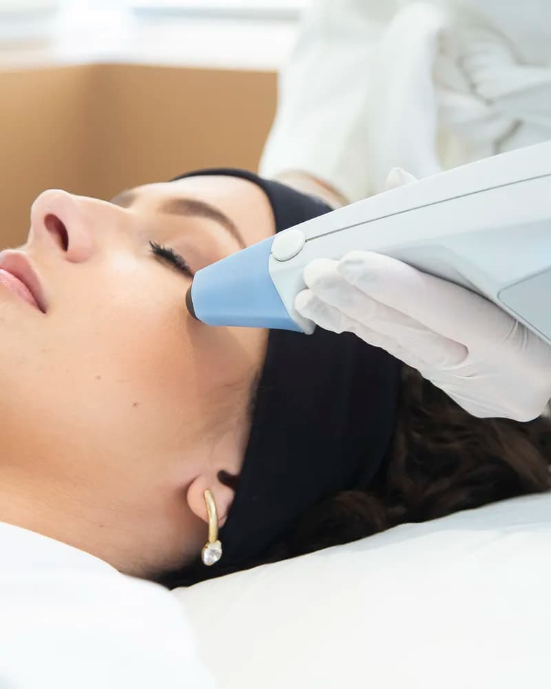Tratamento facial na Delavie